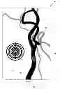 Fig. 01 - Blood vessel sizing device
