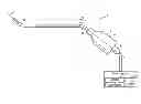Fig. 01 - Ultrasonic treatment probe providing superposed lateral and longitudinal vibration