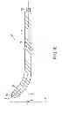 Fig. 08 - Ultrasonic treatment probe providing superposed lateral and longitudinal vibration