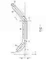 Fig. 09 - Ultrasonic treatment probe providing superposed lateral and longitudinal vibration