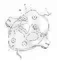 Fig. 01 - Therapeutic appliance
