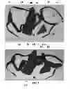 Fig. 02 - Rotation and abduction device for shoulder immobilization
