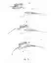Fig. 32 - Closure devices for medical devices and methods