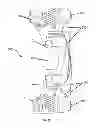 Fig. 05 - Brace For Unloading Of Medial Or Lateral Joint