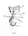 Fig. 09 - Brace For Unloading Of Medial Or Lateral Joint