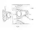 Fig. 15 - Brace For Unloading Of Medial Or Lateral Joint