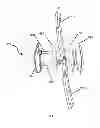 Fig. 16 - Brace For Unloading Of Medial Or Lateral Joint