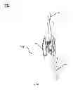 Fig. 18 - Brace For Unloading Of Medial Or Lateral Joint