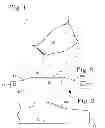 Fig. 02 - MATERNITY SUPPORT BELT