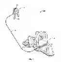 Fig. 02 - Cervical traction systems and method
