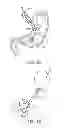Fig. 03 - INTRAGASTRIC IMPLANT DEVICES
