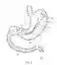 Fig. 05 - INTRAGASTRIC IMPLANT DEVICES