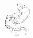 Fig. 06 - INTRAGASTRIC IMPLANT DEVICES
