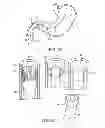 Fig. 07 - INTRAGASTRIC IMPLANT DEVICES