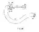 Fig. 15 - INTRAGASTRIC IMPLANT DEVICES