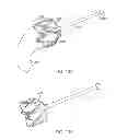Fig. 17 - INTRAGASTRIC IMPLANT DEVICES