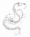 Fig. 27 - INTRAGASTRIC IMPLANT DEVICES