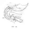 Fig. 31 - INTRAGASTRIC IMPLANT DEVICES
