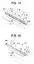 Fig. 07 - Gastric bypass devices and procedures