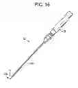 Fig. 08 - Gastric bypass devices and procedures