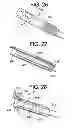Fig. 13 - Gastric bypass devices and procedures