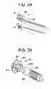 Fig. 14 - Gastric bypass devices and procedures