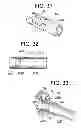 Fig. 15 - Gastric bypass devices and procedures