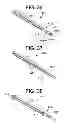 Fig. 17 - Gastric bypass devices and procedures