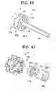 Fig. 19 - Gastric bypass devices and procedures