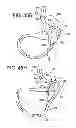 Fig. 24 - Gastric bypass devices and procedures