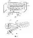 Fig. 06 - SURFACTANT PORTED DEVICE FOR TREATMENT OF BLEPHARITIS AND APPLICATIONS OF SAME