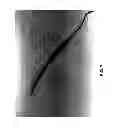 Fig. 09 - SURFACTANT PORTED DEVICE FOR TREATMENT OF BLEPHARITIS AND APPLICATIONS OF SAME