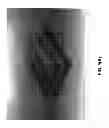 Fig. 12 - SURFACTANT PORTED DEVICE FOR TREATMENT OF BLEPHARITIS AND APPLICATIONS OF SAME