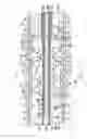Fig. 01 - Catheter having flat beam deflection tip with fiber puller members