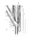 Fig. 07 - Catheter introducer assembly