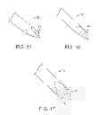 Fig. 07 - NEEDLE FOR DELIVERY OF DERMAL FILLER THREADS