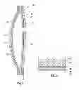 Fig. 02 - Sound absorbing ostomy pouch