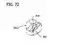 Fig. 62 - Packaged body adhering absorbent article
