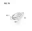 Fig. 68 - Packaged body adhering absorbent article