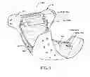 Fig. 02 - Convertible Reusable Diaper