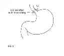 Fig. 04 - USE OF EATING DETECTION TO CONTROL THE RELEASE OF BIOLOGICALLY ACTIVE AGENTS