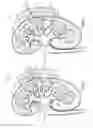 Fig. 02 - SYSTEMS AND METHODS FOR LOCAL DRUG DELIVERY TO KIDNEYS