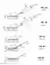 Fig. 04 - DEVICES AND METHODS FOR IMPROVED VASCULAR ACCESS