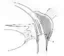 Fig. 01 - Method for treating glaucoma
