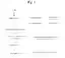 Fig. 02 - Method for treating glaucoma