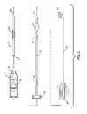 Fig. 03 - Systems and methods for needle and catheter advancement