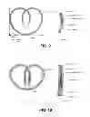 Fig. 05 - Implantable device with intravesical tolerability and methods of treatment