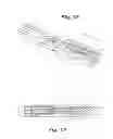 Fig. 07 - Laparoscopic instruments, attachable end effectors and methods relating to same