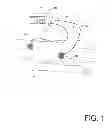 Fig. 02 - APPLICATION OF ENERGY WITH COOLING ELEMENTS FOR SKIN TREATMENT