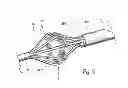 Fig. 35 - Devices, systems and methods for treating tissue regions of the body